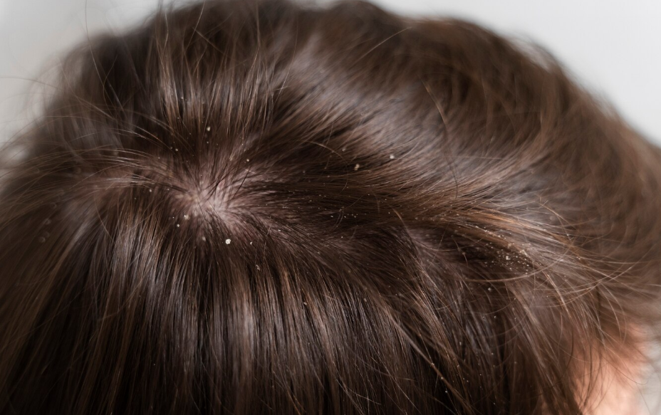 34cdff9596d3a3bb444d173038e24a0894d18f0e